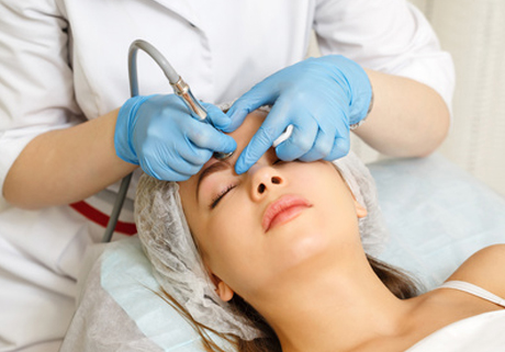 Mikrodermabrasion Behandlung